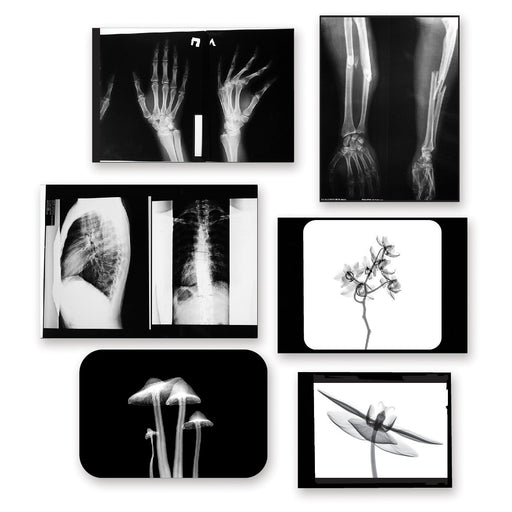 X-Ray Flakes
